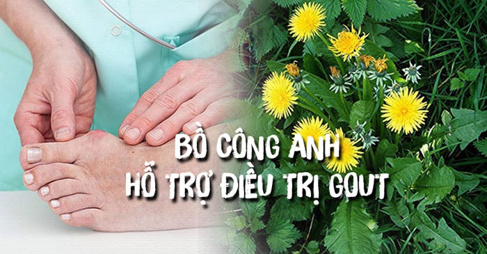bồ công anh bồ công anh